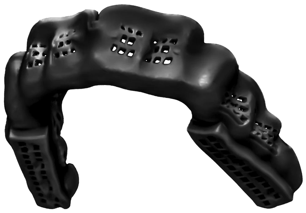 Bulletproof Mouth Guards Black BulletProof Mouthguard for Braces w/ Kevlar - (All Ages) from Lacrosse Fanatic