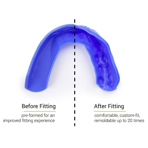 Sisu Mouth Guards Youth / Royal Blue SISU Tether Youth Mouthguard from Lacrosse Fanatic